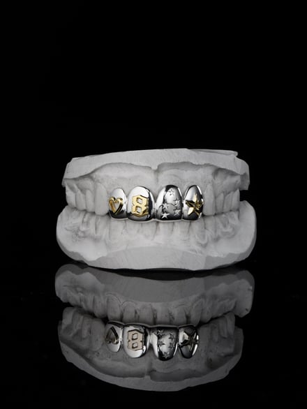 歯型と金歯