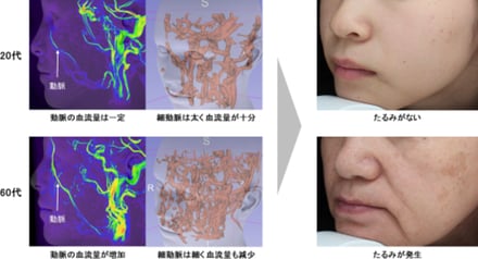 資生堂血流研究画像