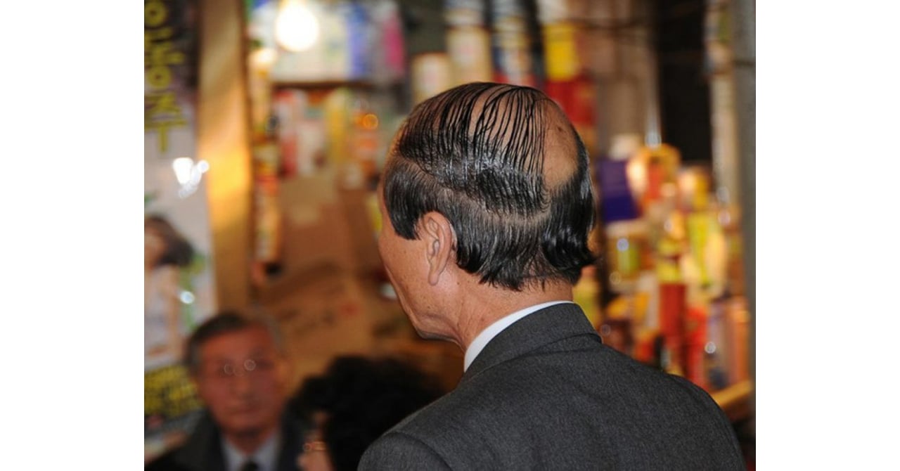 バーコード・ヘアーのオヤジ